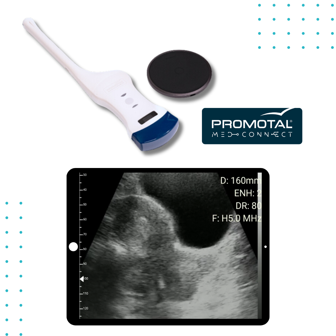 Échographe Ultra Portable Gynécologie Promotal MedConnect