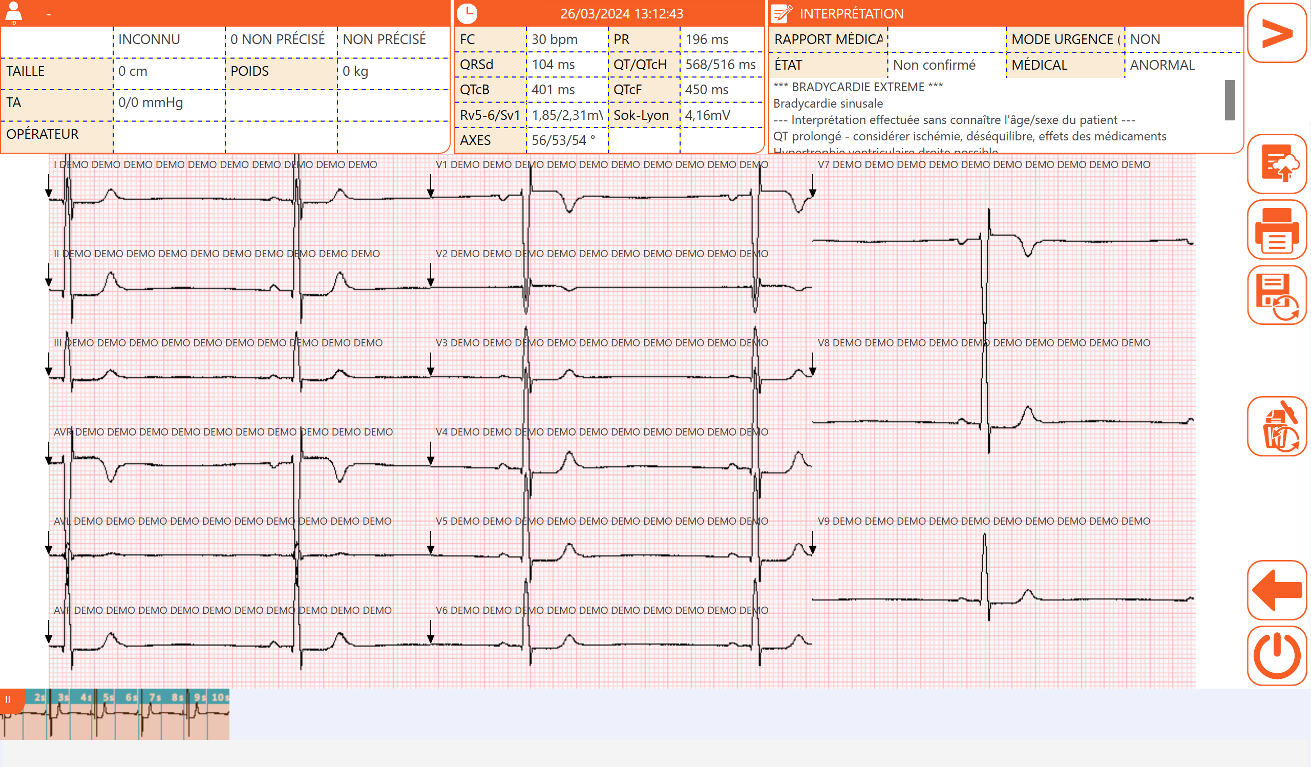 ECG Connecté 12 Pistes