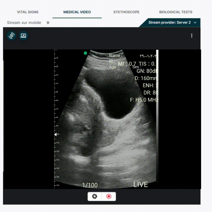 Échographie gynécologique