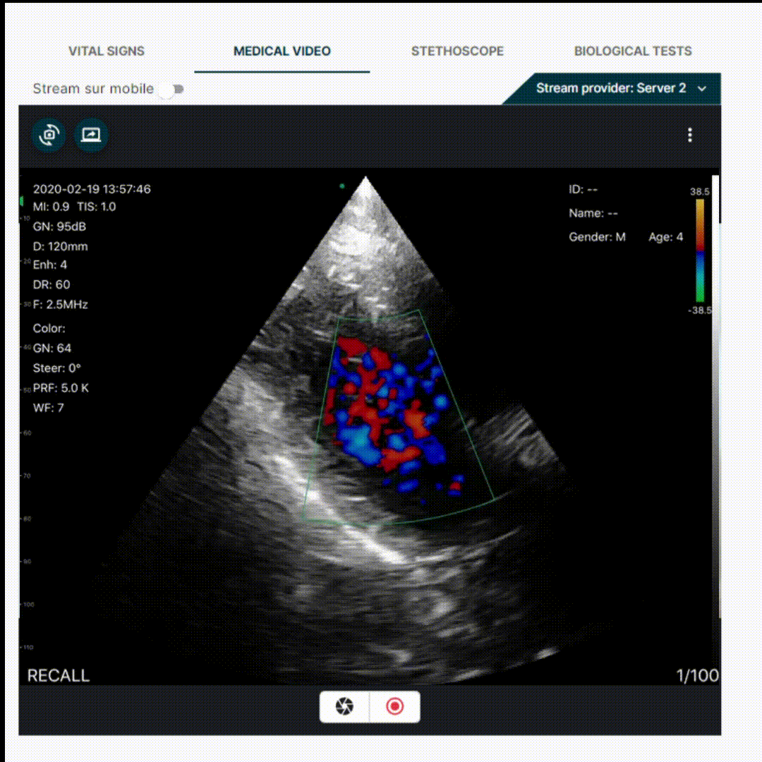 Échographe Ultra Portable